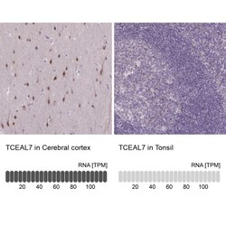 TCEAL7 Antibody, Novus Biologicals 25 &mu;L | Buy Online | Novus Biologicals | Fisher Scientific